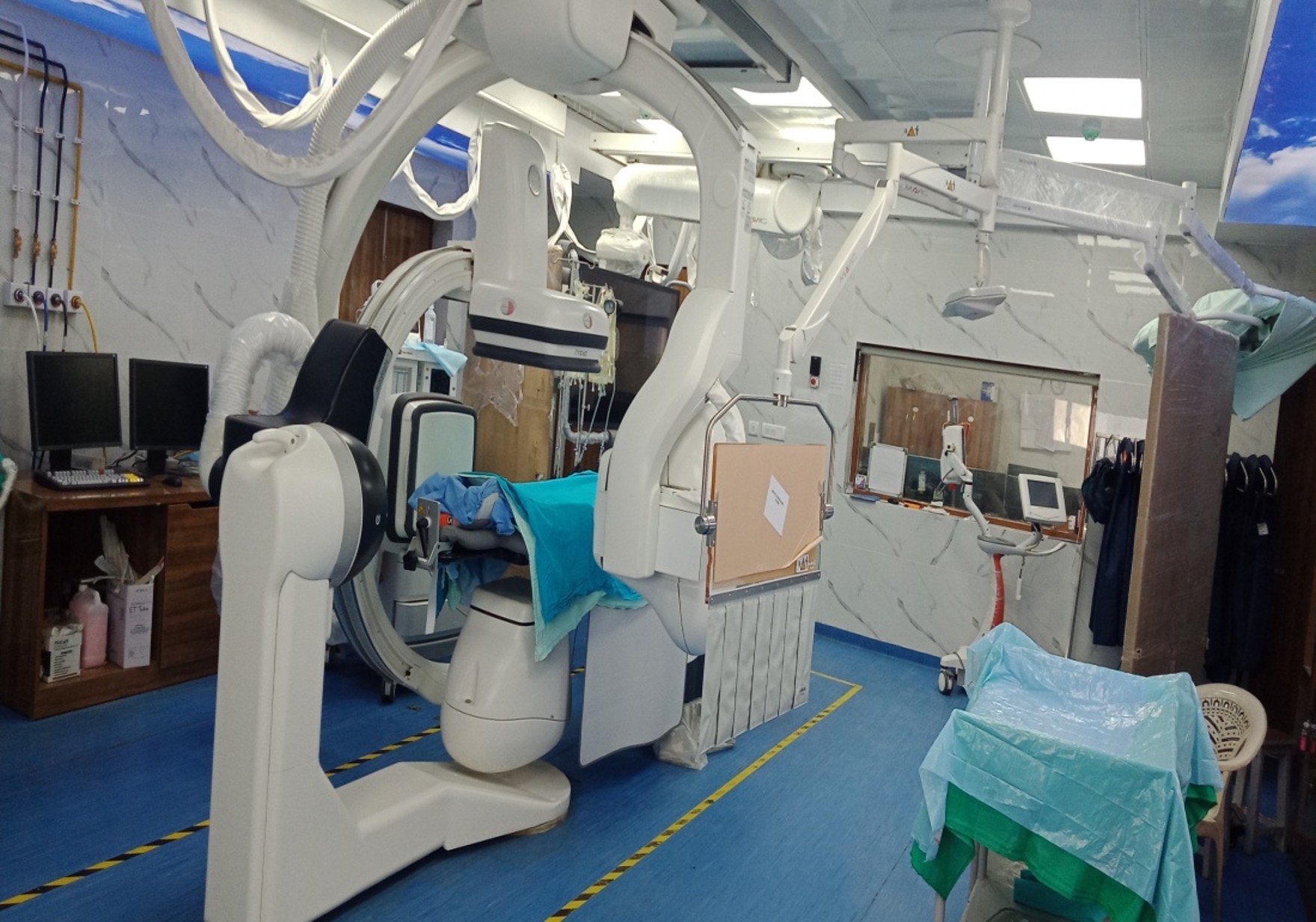 Bi-Plane DSA with CBCT